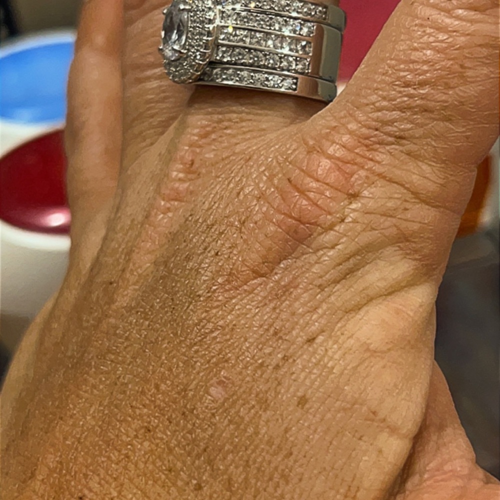 RING 💍 - Picture 3 of 6